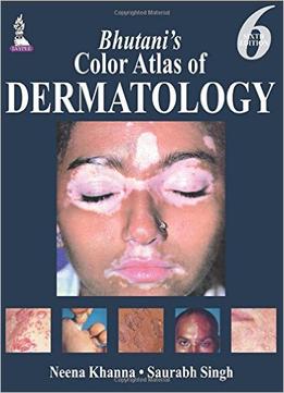 Bhutani’S Color Atlas Of Dermatology, 6Th Edition
