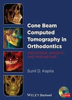 Cone Beam Computed Tomography In Orthodontics: Indications, Insights, And Innovations