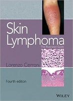 Skin Lymphoma: The Illustrated Guide (4th Edition)