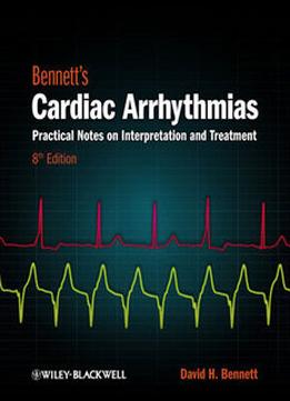 Bennett’S Cardiac Arrhythmias: Practical Notes On Interpretation And Treatment