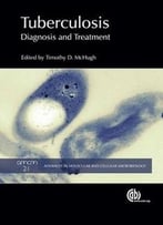 Tuberculosis: Diagnosis And Treatment