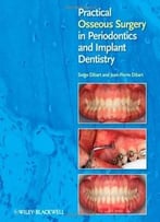 Practical Osseous Surgery In Periodontics And Implant Dentistry