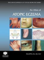An Atlas Of Atopic Eczema (Encyclopedia Of Visual Medicine Series) By Lionel Fry