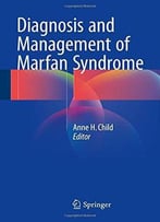 Diagnosis And Management Of Marfan Syndrome