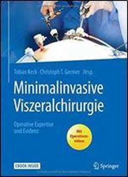 Minimalinvasive Viszeralchirurgie: Operative Expertise Und Evidenz