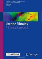 Uterine Fibroids: A Clinical Casebook