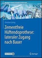 Zementfreie Huftendoprothese: Lateraler Zugang Nach Bauer (Operationstechniken Orthopadie Unfallchirurgie)