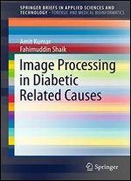 Image Processing In Diabetic Related Causes (springerbriefs In Applied Sciences And Technology)