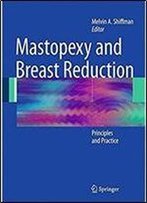 Mastopexy And Breast Reduction: Principles And Practice