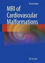 Mri Of Cardiovascular Malformations