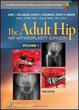 The Adult Hip (two Volume Set): Hip Arthroplasty Surgery