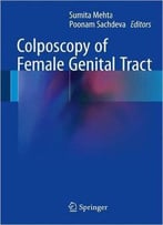 Colposcopy Of Female Genital Tract