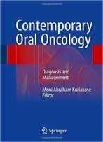 Contemporary Oral Oncology: Diagnosis And Management