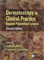 Dermatoscopy In Clinical Practice: Beyond Pigmented Lesions, Second Edition