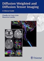Diffusion Weighted And Diffusion Tensor Imaging: A Clinical Guide