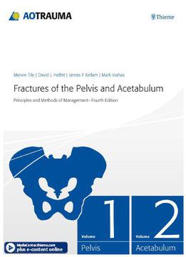 Fractures Of The Pelvis And Acetabulum: Principles And Methods Of Management