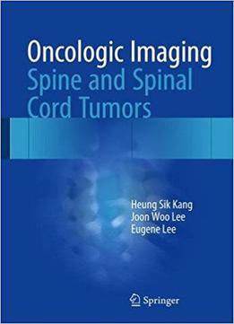 Oncologic Imaging: Spine And Spinal Cord Tumors