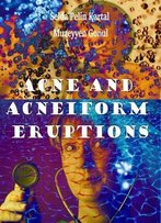 Acne And Acneiform Eruptions Ed. By Selda Pelin Kartal And Muzeyyen Gonul