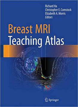 Breast Mri Teaching Atlas