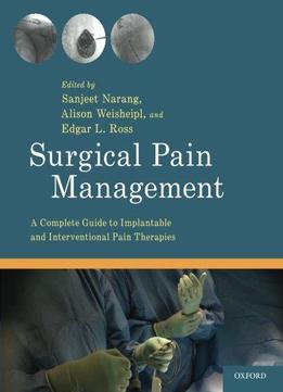 Surgical Pain Management: A Complete Guide To Implantable And Interventional Pain Therapies