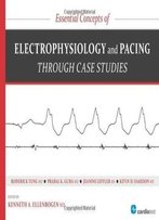 Essential Concepts Of Electrophysiology And Pacing Through Case Studies