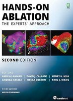 Hands-On Ablation: The Experts' Approach, 2nd Edition