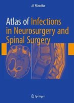 Atlas Of Infections In Neurosurgery And Spinal Surgery