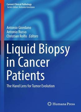 Liquid Biopsy In Cancer Patients: The Hand Lens For Tumor Evolution