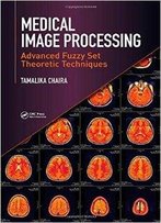 Medical Image Processing: Advanced Fuzzy Set Theoretic Techniques