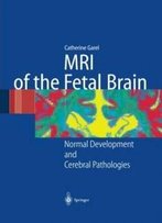 Mri Of The Fetal Brain: Normal Development And Cerebral Pathologies