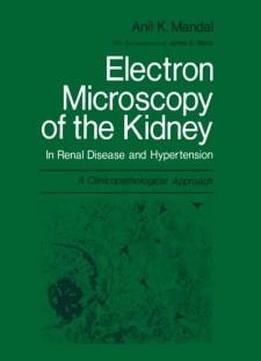Electron Microscopy Of The Kidney: In Renal Disease And Hypertension: A Clinicopathological Approach