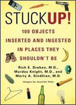 Stuck Up!: 100 Objects Inserted And Ingested In Places They Shouldnt Be
