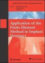 Application Of The Finite Element Method In Implant Dentistry