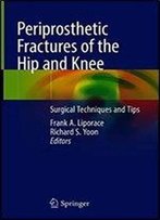 Periprosthetic Fractures Of The Hip And Knee: Surgical Techniques And Tips