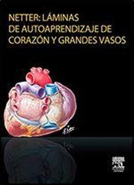 Netter: Laminas De Autoaprendizaje De Corazon Y Grandes Vasos (spanish Edition)