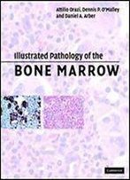 Illustrated Pathology Of The Bone Marrow