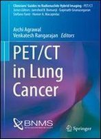 Pet/Ct In Lung Cancer (Clinicians Guides To Radionuclide Hybrid Imaging)