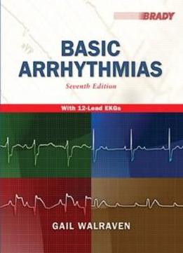 Basic Arrhythmias, 7th Edition
