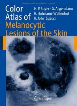 Color Atlas Of Melanocytic Lesions Of The Skin