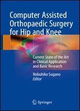 Computer Assisted Orthopaedic Surgery For Hip And Knee: Current State Of The Art In Clinical Application And Basic Research