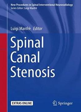 Spinal Canal Stenosis (new Procedures In Spinal Interventional Neuroradiology)