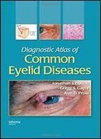 Diagnostic Atlas Of Common Eyelid Diseases