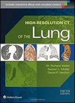 High-Resolution Ct Of The Lung (5th Edition)