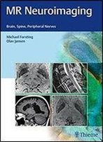 Mr Neuroimaging: Brain, Spine, And Peripheral Nerves