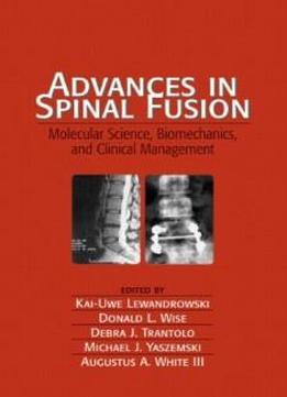 Advances In Spinal Fusion: Molecular Science, Biomechanics, And Clinical Management