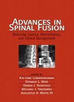 Advances In Spinal Fusion: Molecular Science, Biomechanics, And Clinical Management