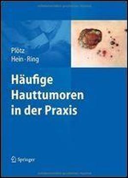 Haeufige Hauttumoren In Der Praxis