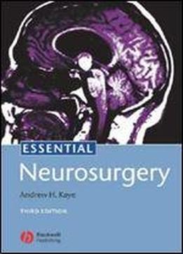 Essential Neurosurgery (3rd Edition)