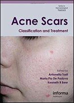 Acne Scars: Classification And Treatment (series In Dermatological Treatment)