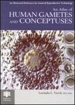 An Atlas Of Human Gametes And Conceptuses: An Illustrated Reference For Assisted Reproductive Technology